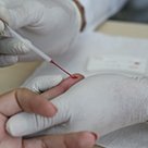 #3568 Campus ofertará teste para Sífilis e HIV